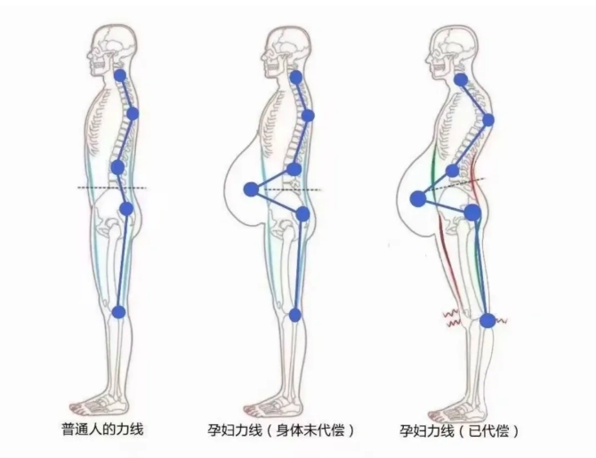 产后疼痛不用愁，冲击波治疗仪来解忧