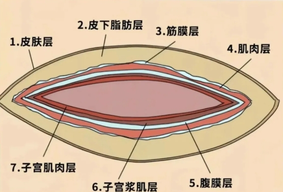 产后疼痛不用愁，冲击波治疗仪来解忧