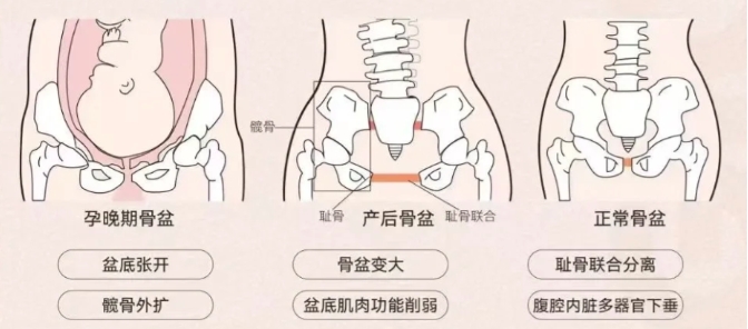 产后疼痛不用愁，冲击波治疗仪来解忧