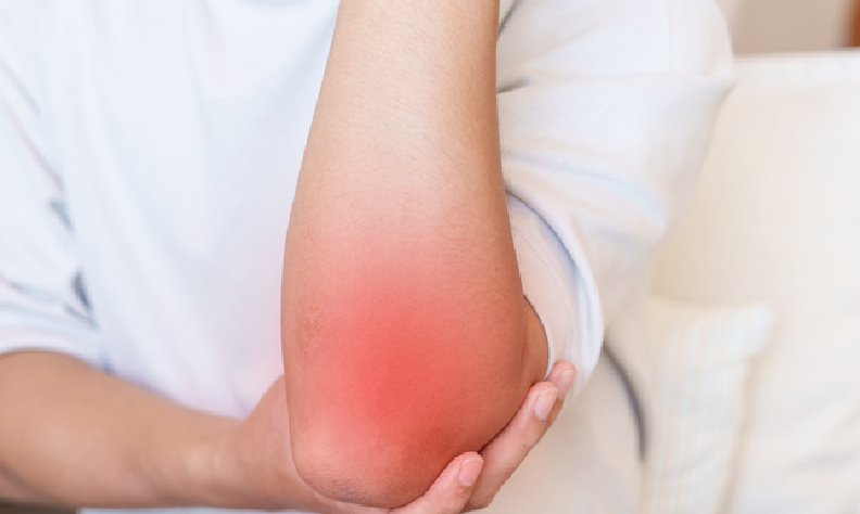 专家共识｜聚焦式体外冲击波治疗肌腱末端病，9 类疾病标准化方案出炉