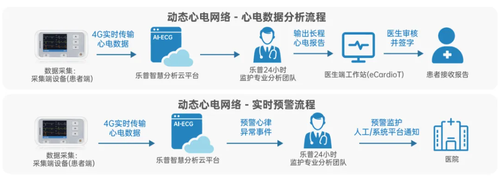 动态心电监测 动态心电监测